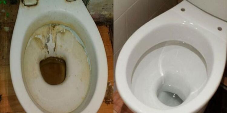 Πουρί και κιτρινίλα στον πάτο της λεκάνης – Kάντε την σαν καινούρια με 3 υλικά που όλοι έχουμε στο σπίτι