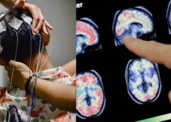 Είχε έντονες ημικρανίες και πήγε στον γιατρό – Όταν εξέτασαν τον εγκέφαλό του έπαθαν σοκ με αυτό που αντίκρισαν