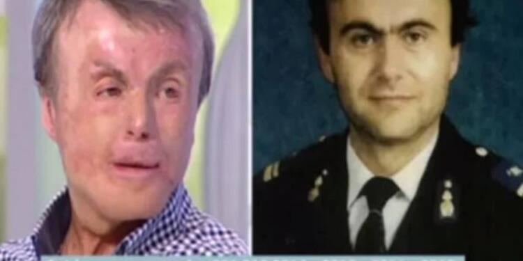 Άγγελος Μπαρμπαγιάννης: O ήρωας πυροσβέστης που έπεσε στη φωτιά για να σώσει τους συναδέρφους του – Τα 60% εγκαύματα σε όλο του το σώμα και τα 18 χειρουργεία (Video)