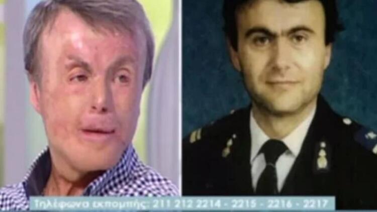 Άγγελος Μπαρμπαγιάννης: O ήρωας πυροσβέστης που έπεσε στη φωτιά για να σώσει τους συναδέρφους του – Τα 60% εγκαύματα σε όλο του το σώμα και τα 18 χειρουργεία (Video)