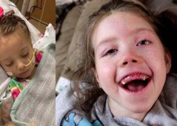 4χρονη έπαθε εγκεφαλική βλάβη από αποσμητικό, γιατί η μητέρα της έκανε ένα λάθος που κάνουν πολλοί γονείς