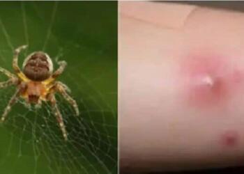 Όλα τούμπα στον Πύργο, από αυτό πέθανε ο 48χρονος και όχι απο αράχνη