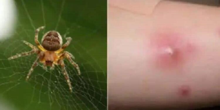 Όλα τούμπα στον Πύργο, από αυτό πέθανε ο 48χρονος και όχι απο αράχνη