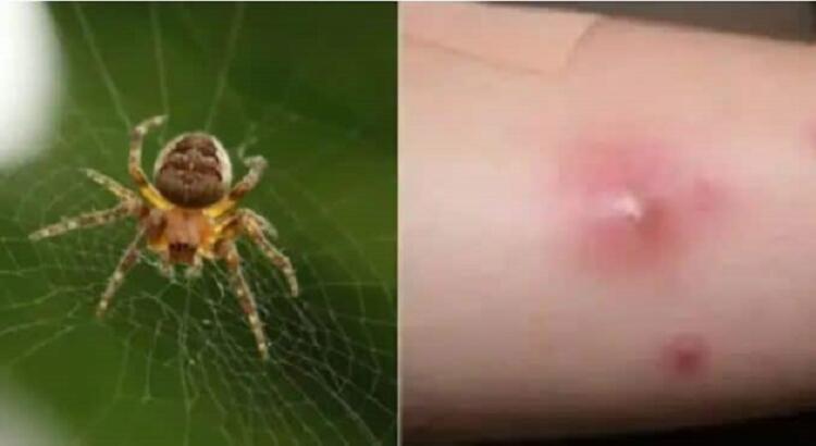 Όλα τούμπα στον Πύργο, από αυτό πέθανε ο 48χρονος και όχι απο αράχνη