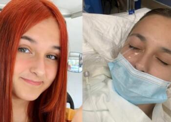 Αληθινός εφιάλτης: 13χρονη τυφλώθηκε από ένα λάθος που κάνουμε όλες οι γυναίκες με τις βαφές μαλλιών! (photo)