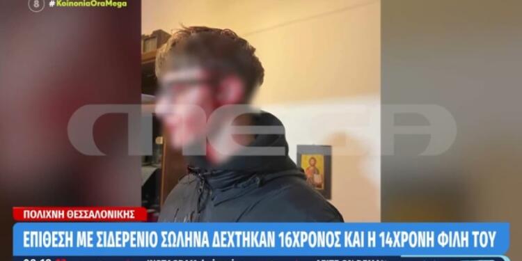 Αδιανόητο: Σακάτεψαν 16χρονο στη Θεσσαλονίκη χτυπώντας τον με μανία στο κεφάλι με μεταλλικό σωλήνα λόγω ζήλειας (video)