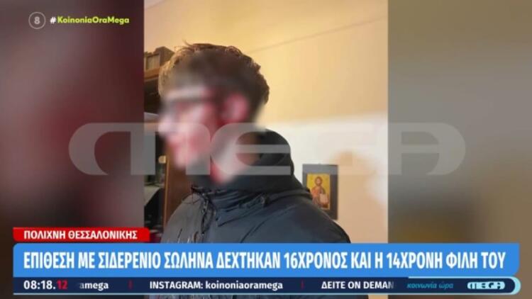 Αδιανόητο: Σακάτεψαν 16χρονο στη Θεσσαλονίκη χτυπώντας τον με μανία στο κεφάλι με μεταλλικό σωλήνα λόγω ζήλειας (video)
