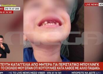 Σοκαριστική καταγγελία: 5χρονα έσπασαν τα δόντια 4χρονου με αυτισμό σε σχολείο – Δε θα μπορεί να φάει για 2 χρόνια