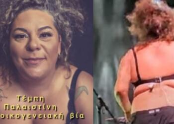 Έκλεισε στόματα η Ματούλα Ζαμάνη για όλο το σούσουρο με την μπλούζα: «15 μέρες μετά τη συναυλία, κιτρινίλα και γλίτσα…»