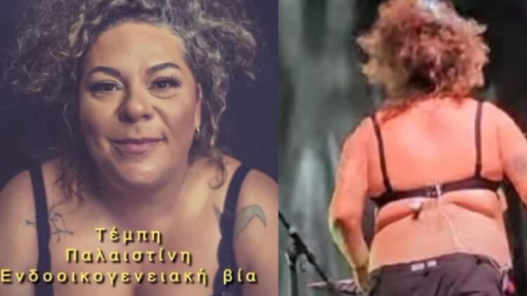 Έκλεισε στόματα η Ματούλα Ζαμάνη για όλο το σούσουρο με την μπλούζα: «15 μέρες μετά τη συναυλία, κιτρινίλα και γλίτσα…»