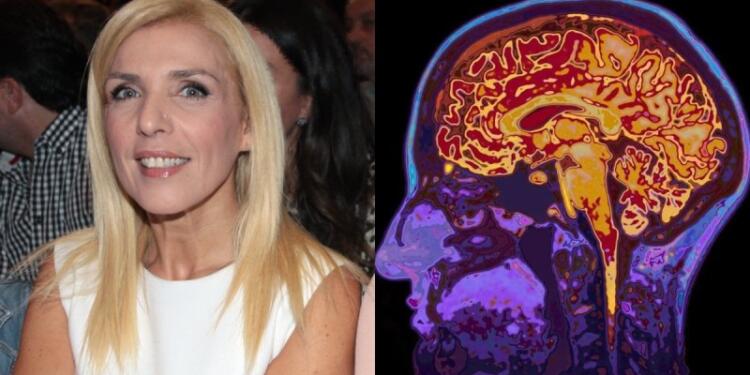 Τι είναι η «συρρίκνωση εγκεφάλου», η ασθένεια που έχει η δημοσιογράφος Ρένα Κουβελιώτη;