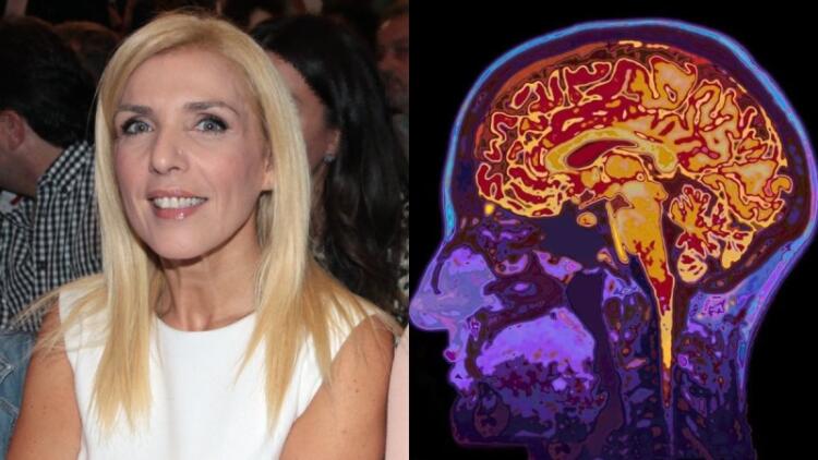 Τι είναι η «συρρίκνωση εγκεφάλου», η ασθένεια που έχει η δημοσιογράφος Ρένα Κουβελιώτη;