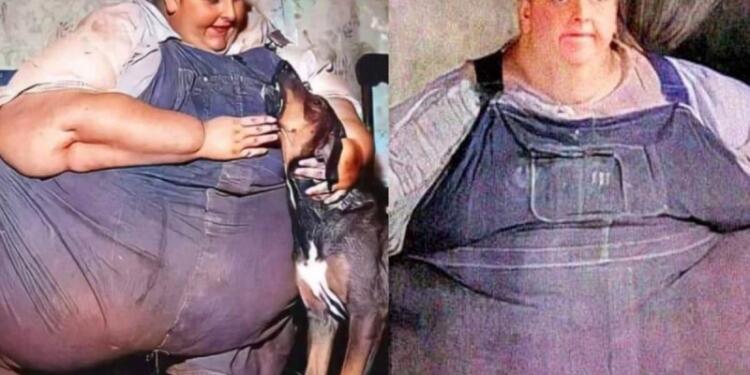 Ο παχύτερος άνθρωπος στον κόσμο: 12 ετών ζύγιζε 132 κιλά – Έφτασε μέχρι τα 635 και πέθανε στα 41 του (video)