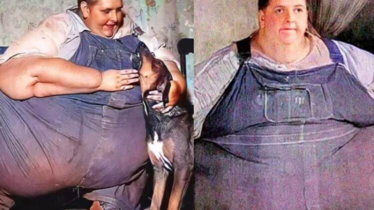 Ο παχύτερος άνθρωπος στον κόσμο: 12 ετών ζύγιζε 132 κιλά – Έφτασε μέχρι τα 635 και πέθανε στα 41 του (video)