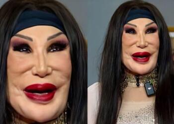 Ήταν πασίγνωστη κούκλα ηθοποιός που εμφανίστηκε σε περίπου 100 ταινίες, αλλά ένα τραγικό λάθος άλλαξε μοιραία την εμφάνισή της