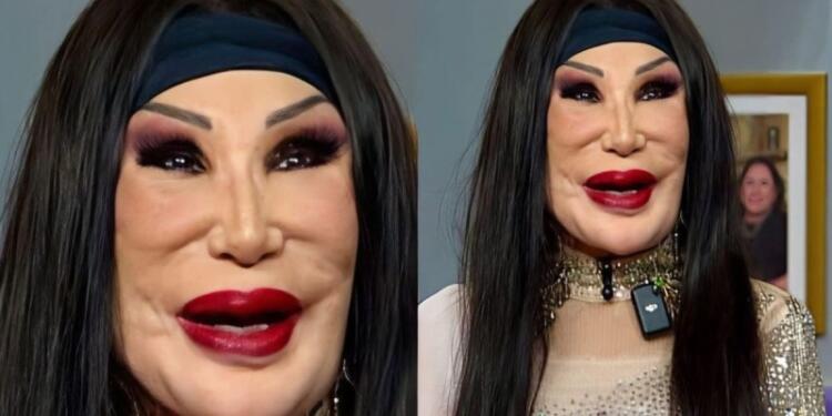 Ήταν πασίγνωστη κούκλα ηθοποιός που εμφανίστηκε σε περίπου 100 ταινίες, αλλά ένα τραγικό λάθος άλλαξε μοιραία την εμφάνισή της