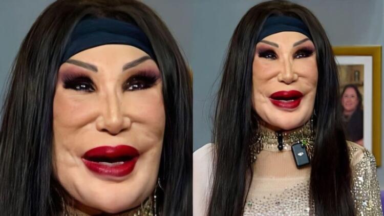 Ήταν πασίγνωστη κούκλα ηθοποιός που εμφανίστηκε σε περίπου 100 ταινίες, αλλά ένα τραγικό λάθος άλλαξε μοιραία την εμφάνισή της