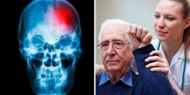 Ειδικά το 5ο κάνει μπαμ: 9 προειδοποιητικά σημάδια εγκεφαλικού επεισοδίου