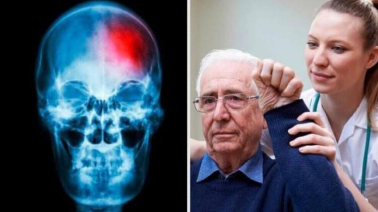 Ειδικά το 5ο κάνει μπαμ: 9 προειδοποιητικά σημάδια εγκεφαλικού επεισοδίου