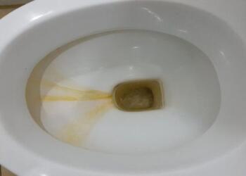 Λεκάνη λαμπίκο με 1 μόνο υλικό: Θαυματουργή έκπληξη που θα εξαφανίσει κάθε ίχνος λεκέ