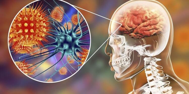 Μηνιγγίτιδα: Γιατί ο ξαφνικός θάνατος του 20χρονου προκαλεί έντονη ανησυχία για νέο… εμβολιασμό; Οι φόβοι των γιατρών