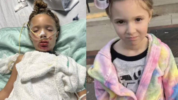 Φρίκη: Σε τεχνητό κώμα 7χρονη μετά από challenge στο TikTok