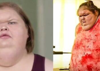 Η γυναίκα που ζύγιζε 330 κιλά – Η προσπάθεια απώλειας βάρους και η σημερινή εμφάνισή της