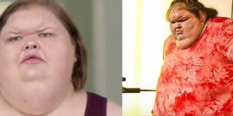 Η γυναίκα που ζύγιζε 330 κιλά – Η προσπάθεια απώλειας βάρους και η σημερινή εμφάνισή της