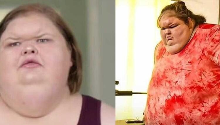 Η γυναίκα που ζύγιζε 330 κιλά – Η προσπάθεια απώλειας βάρους και η σημερινή εμφάνισή της