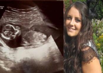 31χρονη δέκα μέρες μετά την έκτρωση πήγε στο γιατρό για εξετάσεις – Σοκαρισμένοι δεν πίστευαν ότι το μωρό…