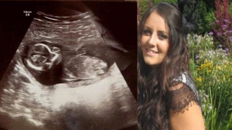 31χρονη δέκα μέρες μετά την έκτρωση πήγε στο γιατρό για εξετάσεις – Σοκαρισμένοι δεν πίστευαν ότι το μωρό…