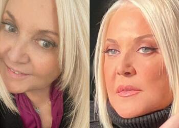 Αγωνία για την υγεία της Ρούλας Κορομηλά: «Άρχισα να αισθάνομαι αδυναμία, μπήκα στο νοσοκομείο και…»