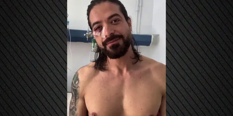 Έσπασε τη σιωπή του ο Άρης Μουγκοπέτρος για το ατύχημα με την κροτίδα που του στέρησε τα 2 δάκτυλα του – «Νόμιζα ότι…»