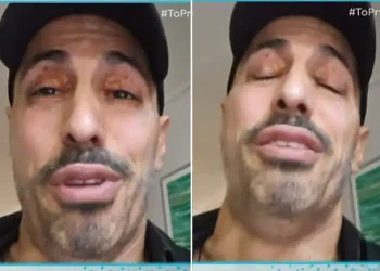 Γιώργος Παράσχος: «Ζητώ συγγνώμη, δεν μπορώ να μιλήσω άλλο» – «Έσπασε» on air για τη μάχη του με τον καρκίνο