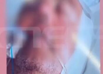 Χαροπαλεύει ο 48χρονος που ξυλοκοπήθηκε στα Γλυκά Νερά – Άπορη η μητέρα του, ζει χωρίς ρεύμα