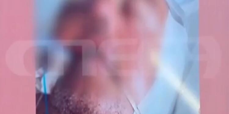 Χαροπαλεύει ο 48χρονος που ξυλοκοπήθηκε στα Γλυκά Νερά – Άπορη η μητέρα του, ζει χωρίς ρεύμα