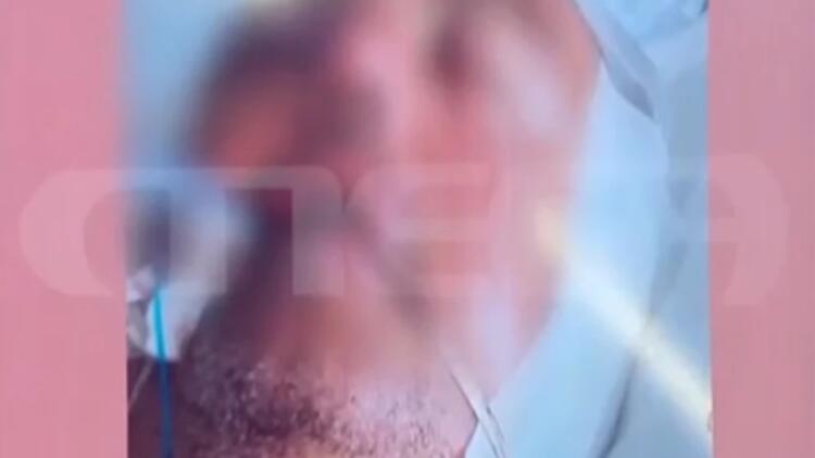 Χαροπαλεύει ο 48χρονος που ξυλοκοπήθηκε στα Γλυκά Νερά – Άπορη η μητέρα του, ζει χωρίς ρεύμα