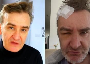 Νίκος Ορφανός: Χειρουργείο για όγκο στον εγκέφαλο για τον γνωστό ηθοποιό – Η περιπέτεια που κανείς δε γνώριζε