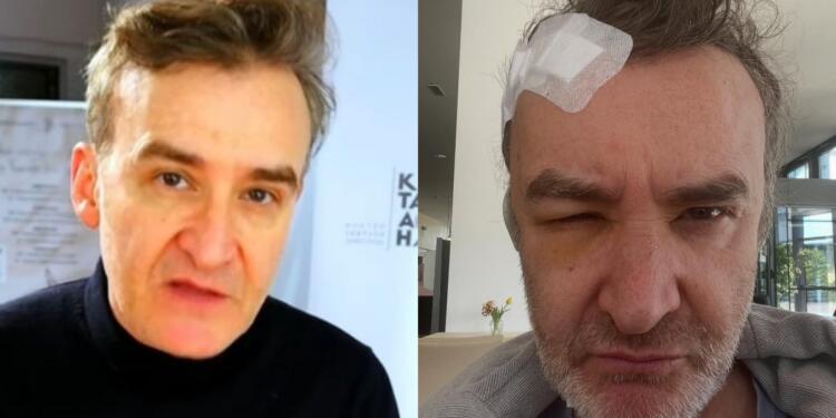 Νίκος Ορφανός: Χειρουργείο για όγκο στον εγκέφαλο για τον γνωστό ηθοποιό – Η περιπέτεια που κανείς δε γνώριζε