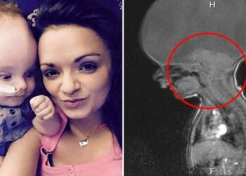 Τους έλεγαν να ρίξουν το μωρό και δεν άκουσαν κανένα – Σήμερα ο κόσμος παραμιλά με το παιδί «θαύμα»