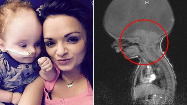 Τους έλεγαν να ρίξουν το μωρό και δεν άκουσαν κανένα – Σήμερα ο κόσμος παραμιλά με το παιδί «θαύμα»