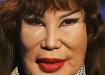 Ήταν μια διάσημη ηθοποιός που εμφανίστηκε σε περίπου 100 ταινίες, αλλά ένα τραγικό λάθος άλλαξε άρδην την εμφάνισή της