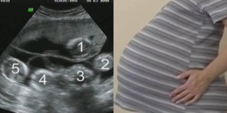 Έγκυος είχε πάει για τον προγραμματισμένο υπέρηχο – Ο γιατρός της είπε κάτι που της κόπηκε η ανάσα!