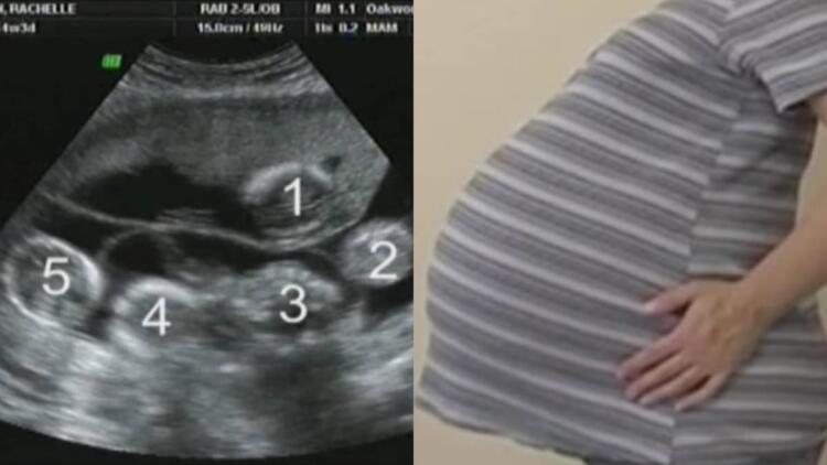 Έγκυος είχε πάει για τον προγραμματισμένο υπέρηχο – Ο γιατρός της είπε κάτι που της κόπηκε η ανάσα!