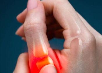 Αρθρίτιδα: Τι να φάτε όταν προσέξετε αυτά τα συμπτώματα