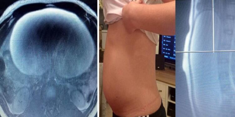 Ο γιατρός υποψιαζόταν 18χρονη ήθελε να κρύψει ότι είναι έγκυος – Τελικά ήταν πολύ χειρότερα τα πράγματα