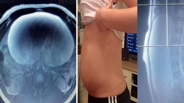 Ο γιατρός υποψιαζόταν 18χρονη ήθελε να κρύψει ότι είναι έγκυος – Τελικά ήταν πολύ χειρότερα τα πράγματα