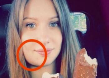 Αυτή η έγκυος ξύπνησε και είδε το σαγόνι της πρησμένο – Μόλις πήγε στο νοσοκομείο ανακάλυψε κάτι ανατριχιαστικό!