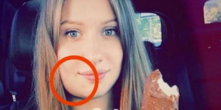 Αυτή η έγκυος ξύπνησε και είδε το σαγόνι της πρησμένο – Μόλις πήγε στο νοσοκομείο ανακάλυψε κάτι ανατριχιαστικό!