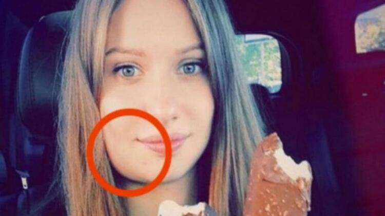 Αυτή η έγκυος ξύπνησε και είδε το σαγόνι της πρησμένο – Μόλις πήγε στο νοσοκομείο ανακάλυψε κάτι ανατριχιαστικό!